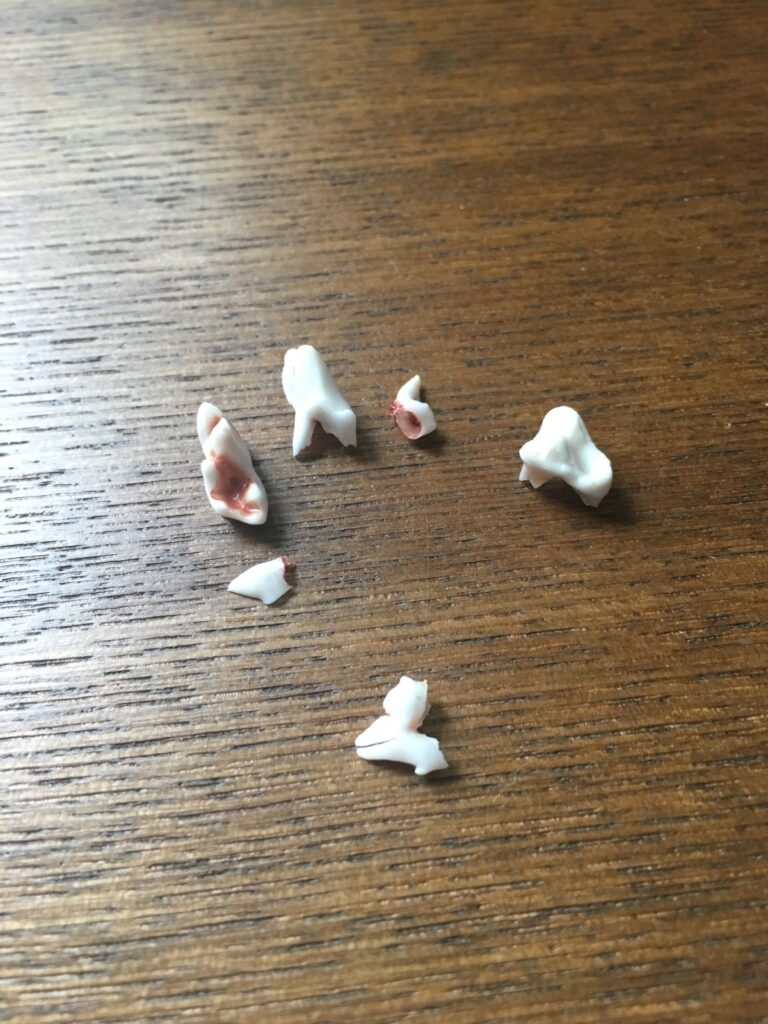A collection of a puppy's milk teeth. They are tiny and white as milk!